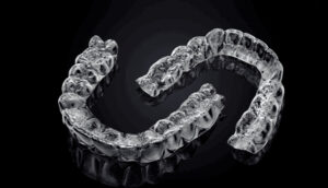 Clear aligners 703 x 402