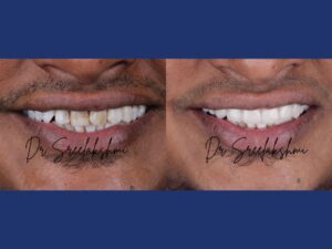 Smile Makeover Expert Dr. Sreelakshmi