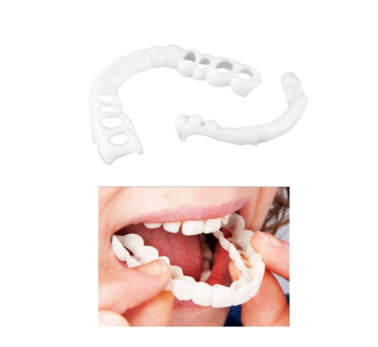 Dental Veneers - Kannamangala