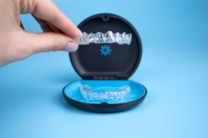 Invisalign Braces - Kannamangala