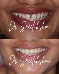 Smile Makeover Expert Dr. Sreelakshmi