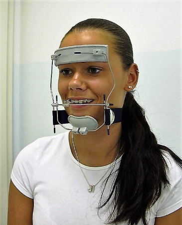 Ortho Appliance