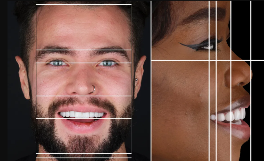 smile correction