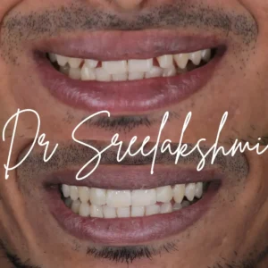 best smile makeover