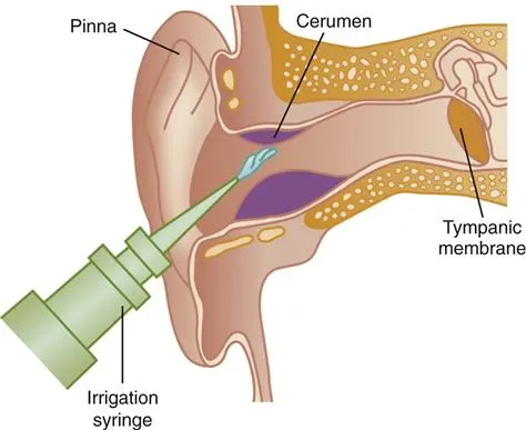 ear wax removal in bangalore ear cleaning