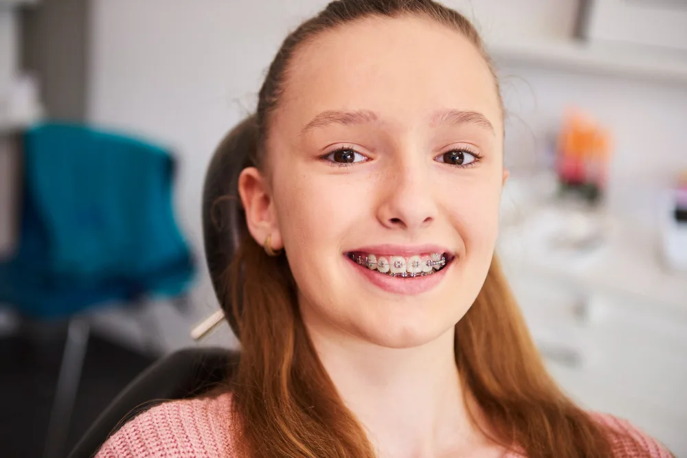 Choosing the Right Braces Colour